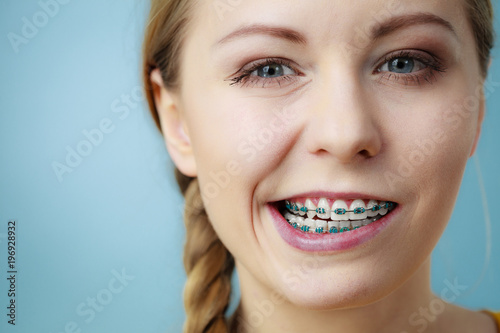 Closeup of woman teeth with braces, funny face