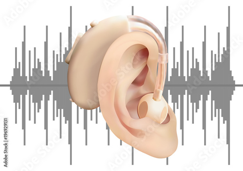 Digital hearing aid behind the ear, on the background of sound wave diagram. Treatment and prosthetics of hearing loss in otolaryngology. Realistic vector illustration. Medicine and health.
