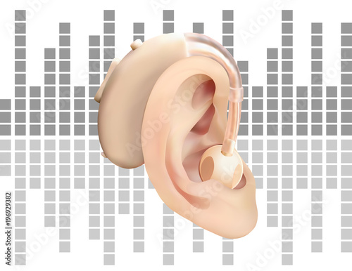 Digital hearing aid behind the ear, on the background of sound wave diagram. Treatment and prosthetics of hearing loss in otolaryngology. Realistic vector illustration. Medicine and health.