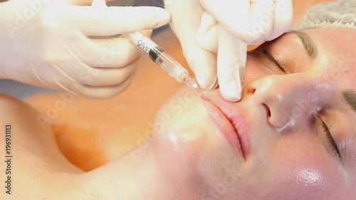 Beauty clinic concept. Close-up of beautician hands making botox injection to female lips and nose. Young woman gets facial injection procedur.. Facial rejuvenation. 4k