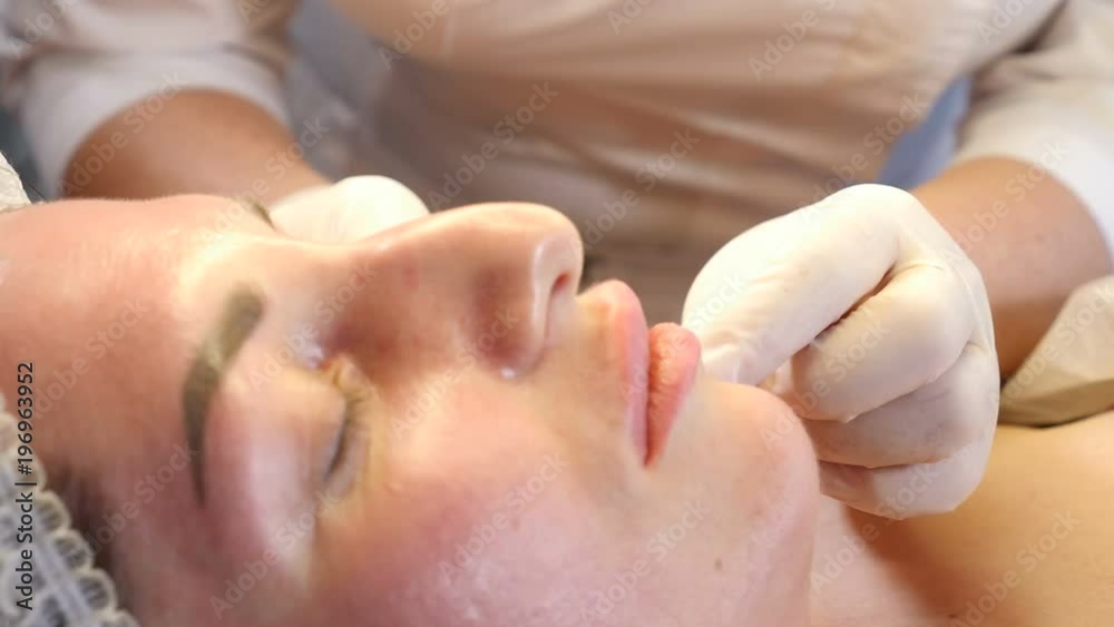 Beauty clinic concept. Close-up of beautician hands making botox injection to female lips. Young woman gets facial injection procedur.. Facial rejuvenation. 4k Beauty clinic concept. Close-up of beautician hands making botox injection to female lips. Young woman gets facial injection procedur.. Facial rejuvenation. 4k