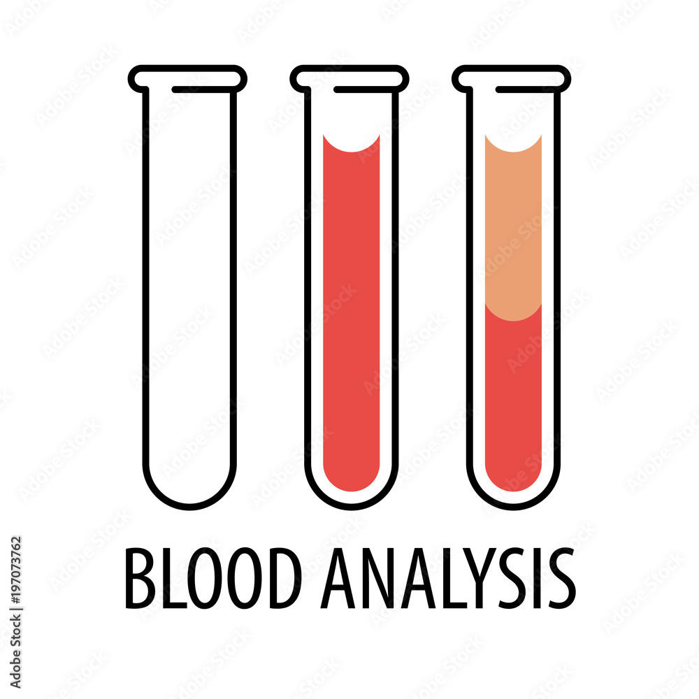 plasma and layers red blood cells plasma and layers red blood cells