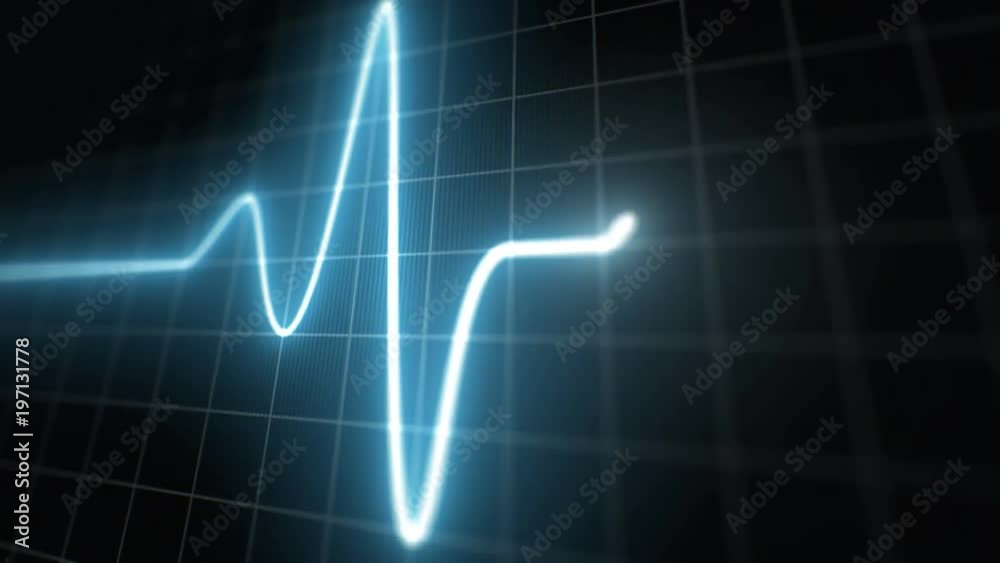 Stylized EKG Normal, Blue. Heart rate monitor / electrocardiogram (EKG or ECG) loop beeping at 60 beats per minute. Shallow depth of field, LCD pixels, 60fps.