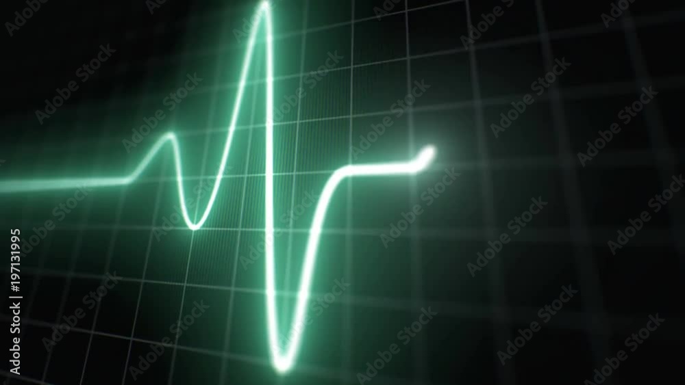 Stylized EKG Normal, Green. Heart rate monitor / electrocardiogram (EKG or ECG) loop beeping at 60 beats per minute. Shallow depth of field, LCD pixels, 60fps. Stylized EKG Normal, Green. Heart rate monitor / electrocardiogram (EKG or ECG) loop beeping at 60 beats per minute. Shallow depth of field, LCD pixels, 60fps.
