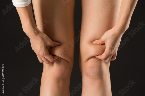 膝上の脂肪をつまむ女性