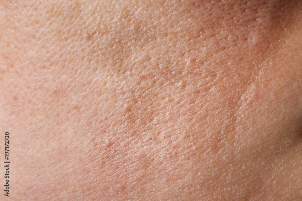 Face skin of young lady between 30 and 35 years old. Closeup