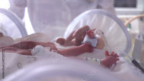 Maternity centre. .Severely ill newborn in incubator, intensive hospital therapy: CCU, ICU, ITU. The tiny baby child moves his fingers, foot and leg vigorously., Closeup