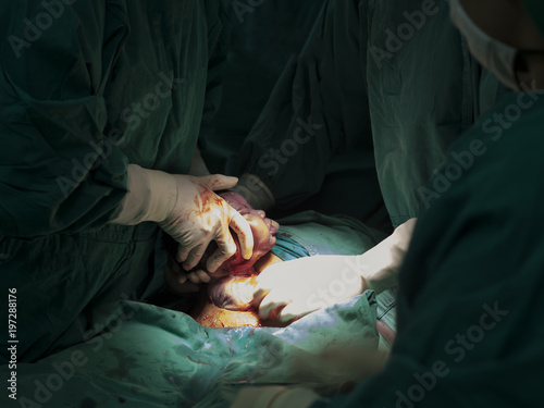 Foto Hands of surgeon or doctor wearing surgical sterile gloves and delivering the ne