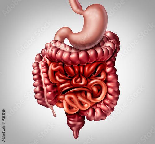 фотографія Irritable Bowel Syndrome