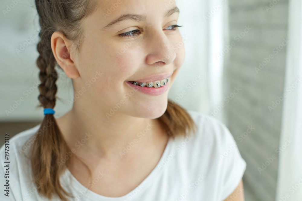 Girl with braces
Girl with braces