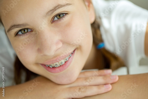 Girl with braces 