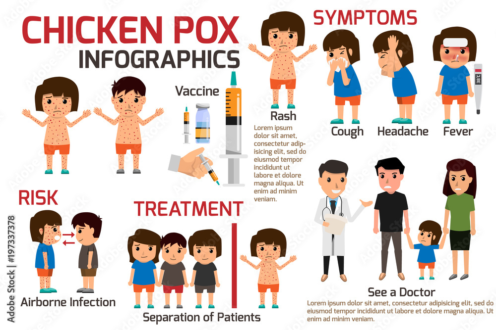 Children has chicken pox infographic, Poster children fever and chickenpox  symptoms and prevention. Health care cartoon character vector illustration.  Stock-vektor | Adobe Stock