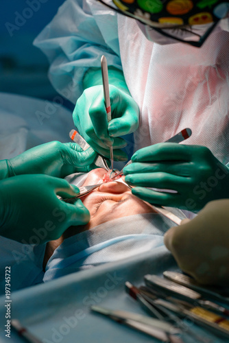 Plastic surgery of the nose in operating room  rhinoplasty