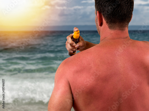 Man with sunburned skin