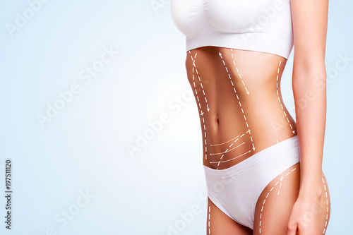 Female body cosmetic surgery and skin liposuction. photo