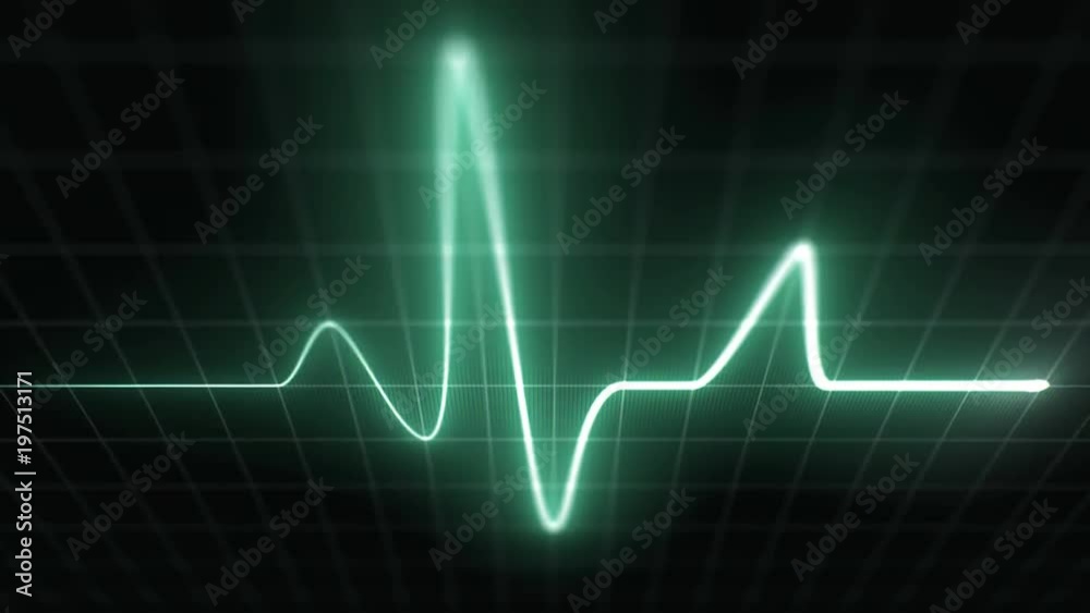 Stylized EKG Fast, Green. Heart rate monitor / electrocardiogram (EKG or ECG) loop beeping at 120 beats per minute. Shallow depth of field, LCD pixels, 60fps. Stylized EKG Fast, Green. Heart rate monitor / electrocardiogram (EKG or ECG) loop beeping at 120 beats per minute. Shallow depth of field, LCD pixels, 60fps.