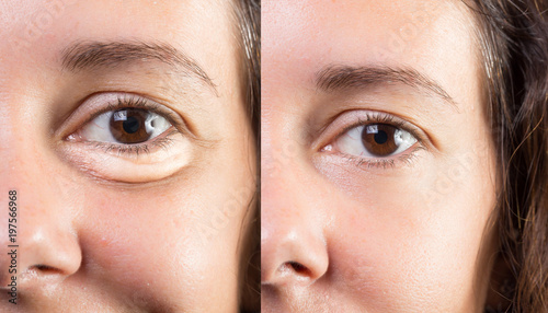 Foto Half face of smiling lady showing age signs