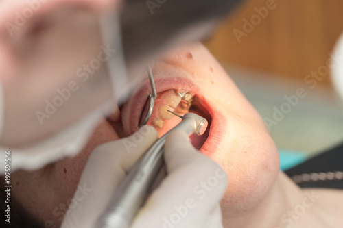 A dentist makes teeth to a woman