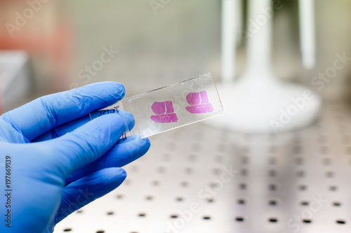 Hand in blue glove with histological liver tissue sample