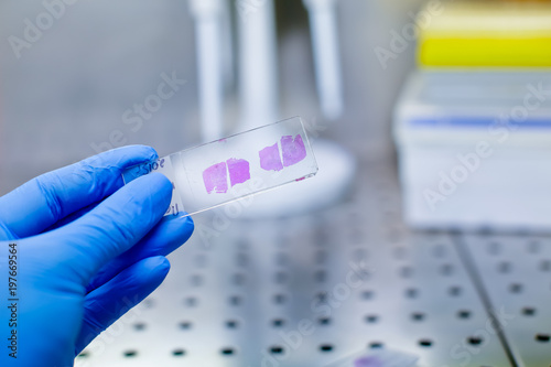 Hand in blue glove with histological liver tissue sample