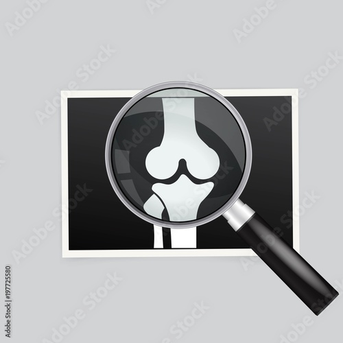 X-ray of the knee magnifying glass search