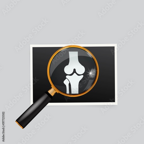 X-ray of the knee magnifying glass search
