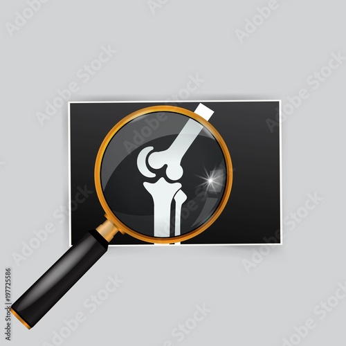 X-ray of the knee magnifying glass search
