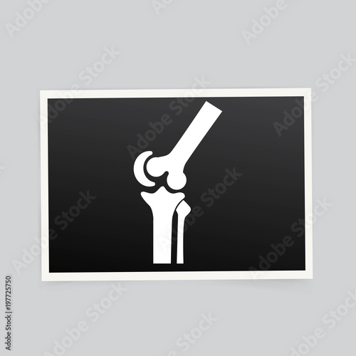 X-ray of the knee. Vector illustration.