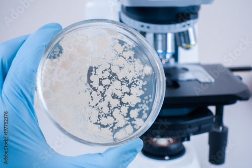 Close-up laboratory microscope and petri dish with bacteria. Analysis of bacterial culture under a microscope. Study of bacteria under a microscope. Scientific research in the laboratory.