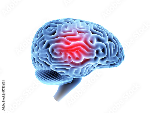 Headache area on brain X-ray, side view isolated on white background. 3D illustration.