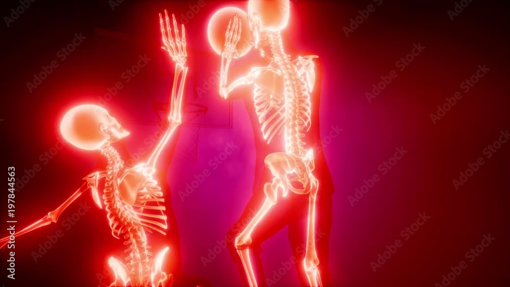 basketball game players with visible bones basketball game players with visible bones