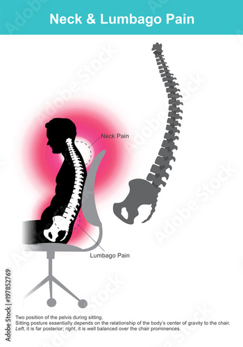 Neck & Lumbago Pain. Illustration.