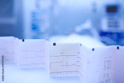 Bilde på lerret ECG chart accordion-folded on the nurse's table on the background of patient lyi