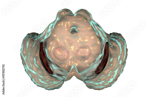 Black substance in Parkinson's disease, 3D illustration showing decrease of its volume. There is degeneration of dopaminergic neurons in the pars compacta of the black substance photo