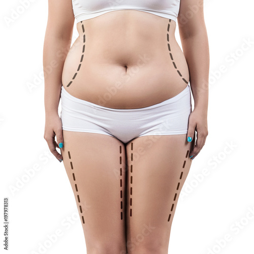 Fat woman with dotted lines on her body.