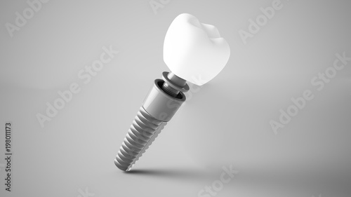 dental implant 3d rendering photo