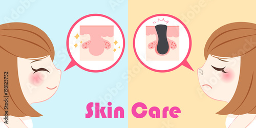 beauty woman with blackhead problem