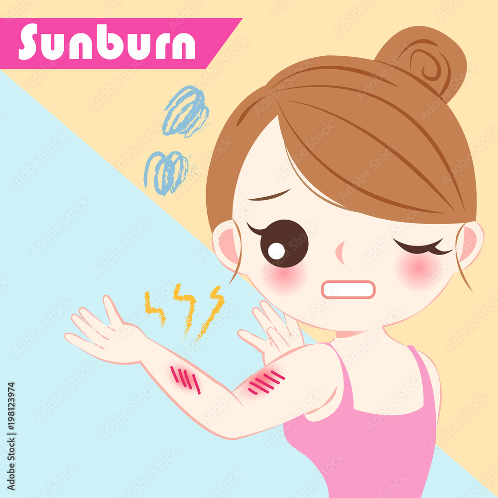 cartoon woman with sunburn problem