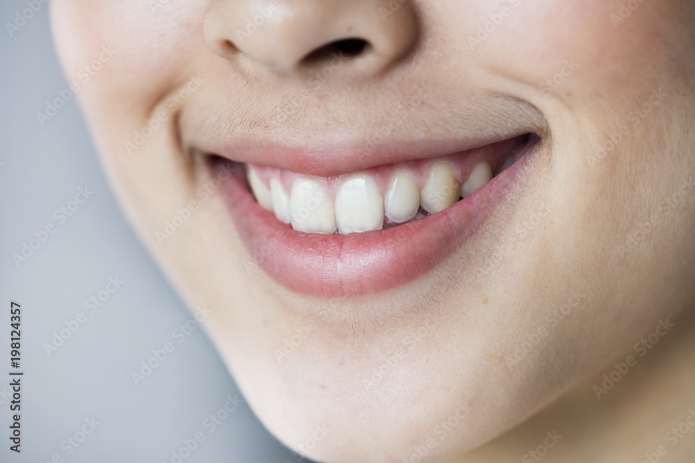 Naklejka premium Close up portrait of Young Asian girl teeth smiling