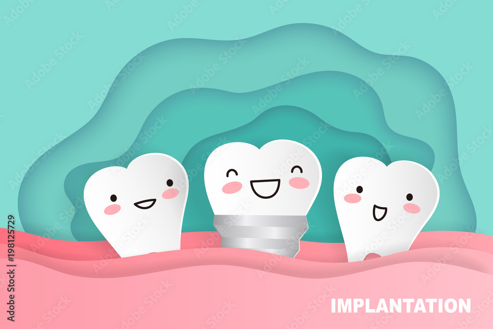 cartoon tooth implant cartoon tooth implant