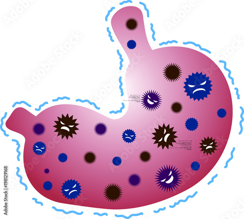 Unhealthy Stomach illustration