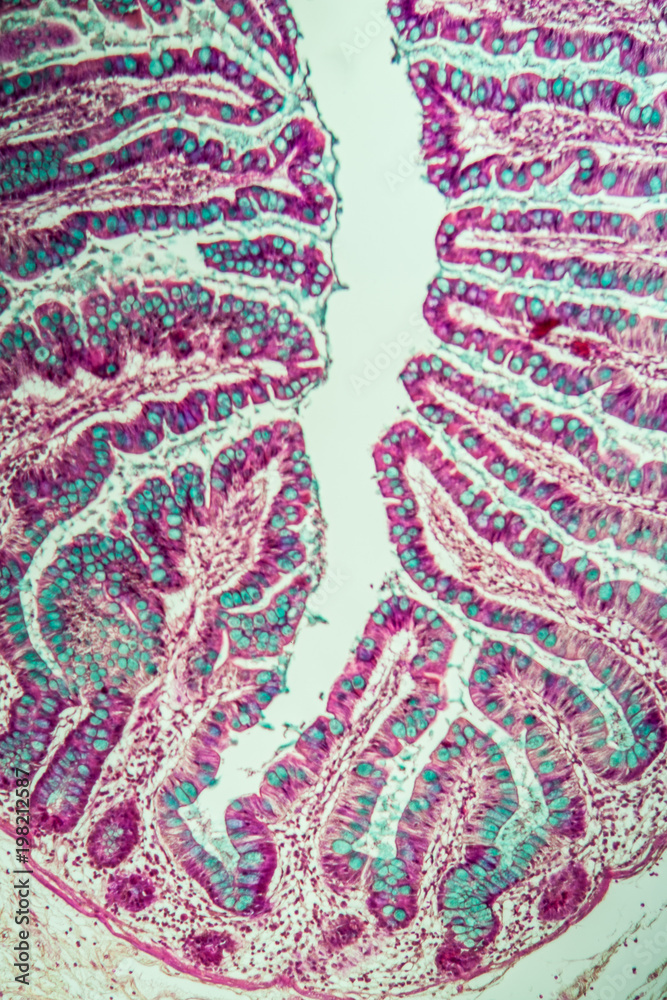 Dünndarm mit Darmzotten unter dem Mikroskop 100x