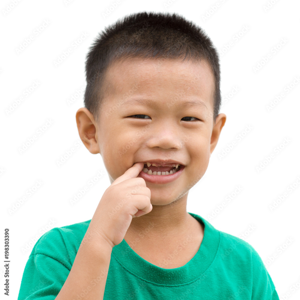 Asian child pointing teeth Asian child pointing teeth