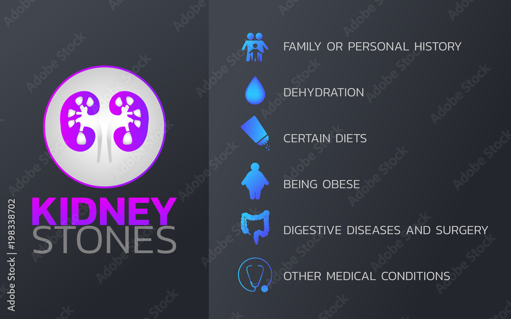 Naklejka premium Kidney Stones icon design, infographic health, medical infographic. Vector illustration