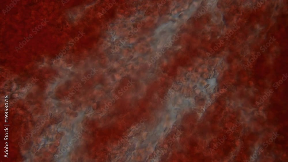 movement of blood under the microscope movement of blood under the microscope