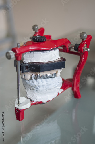 Billede på lærred Adjustable dental articulator with metal tooth crowns