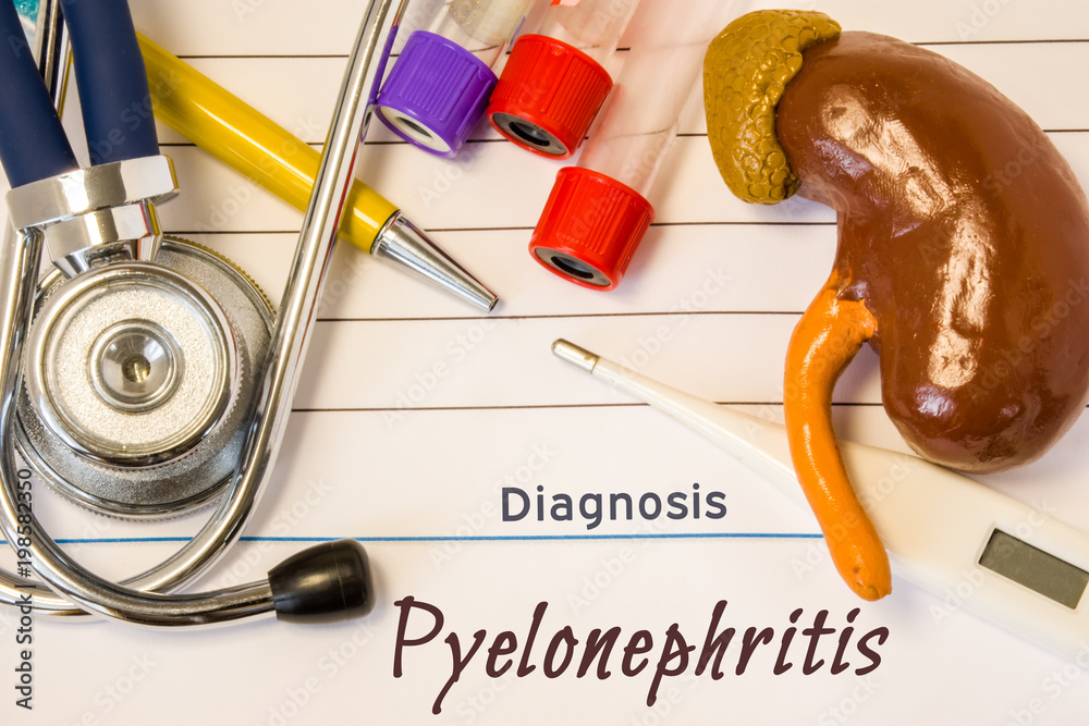 Diagnosis Pyelonephritis photo. Figure of kidney lies next to