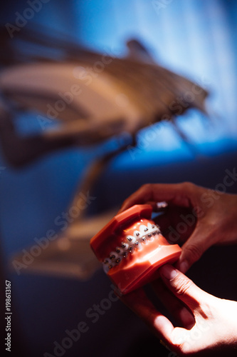 Hands holding model of human jaw with dental braces