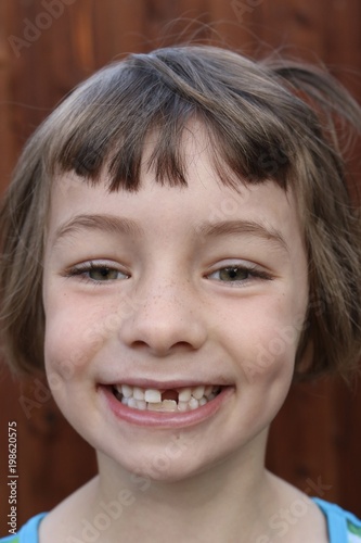 Close up of a giddy little girl that just lost a tooth © Cat