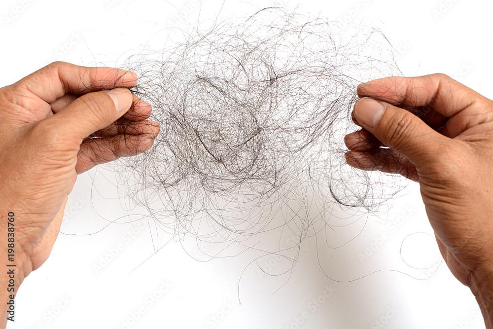 Hand holding hair loss, hair fall everyday serious problem, on white background. Stock Photo | Adobe Stock Hand holding hair loss, hair fall everyday serious problem, on white background. Stock Photo | Adobe Stock